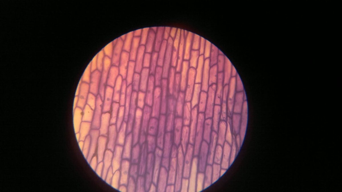 Onion-peel epidermal cells under the microscope